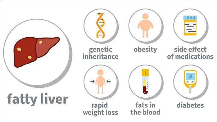 Non Alcoholic Fatty Liver Disease Solution
